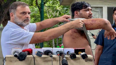 ‘Who approved pellet guns?’ Rahul Gandhi writes Amit Shah over ‘barbaric assault’ on students | India News